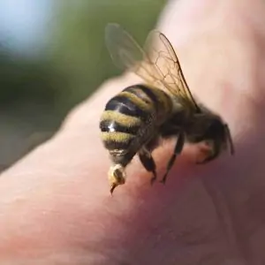 A Beekeeper’s Guide to Bee Stings